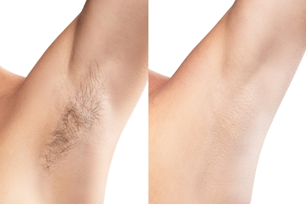 Painless Cream Wax