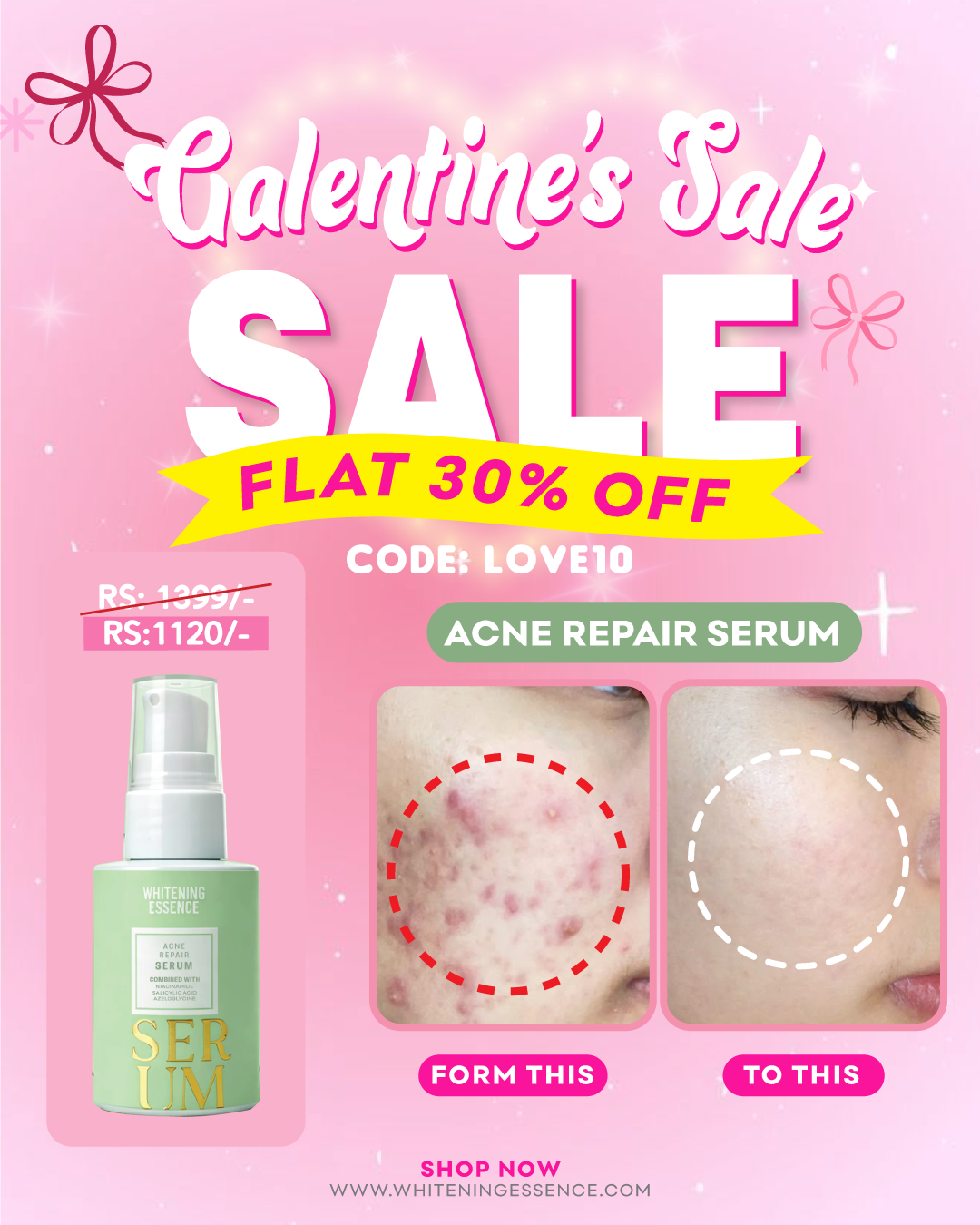 Acne Repair Serum