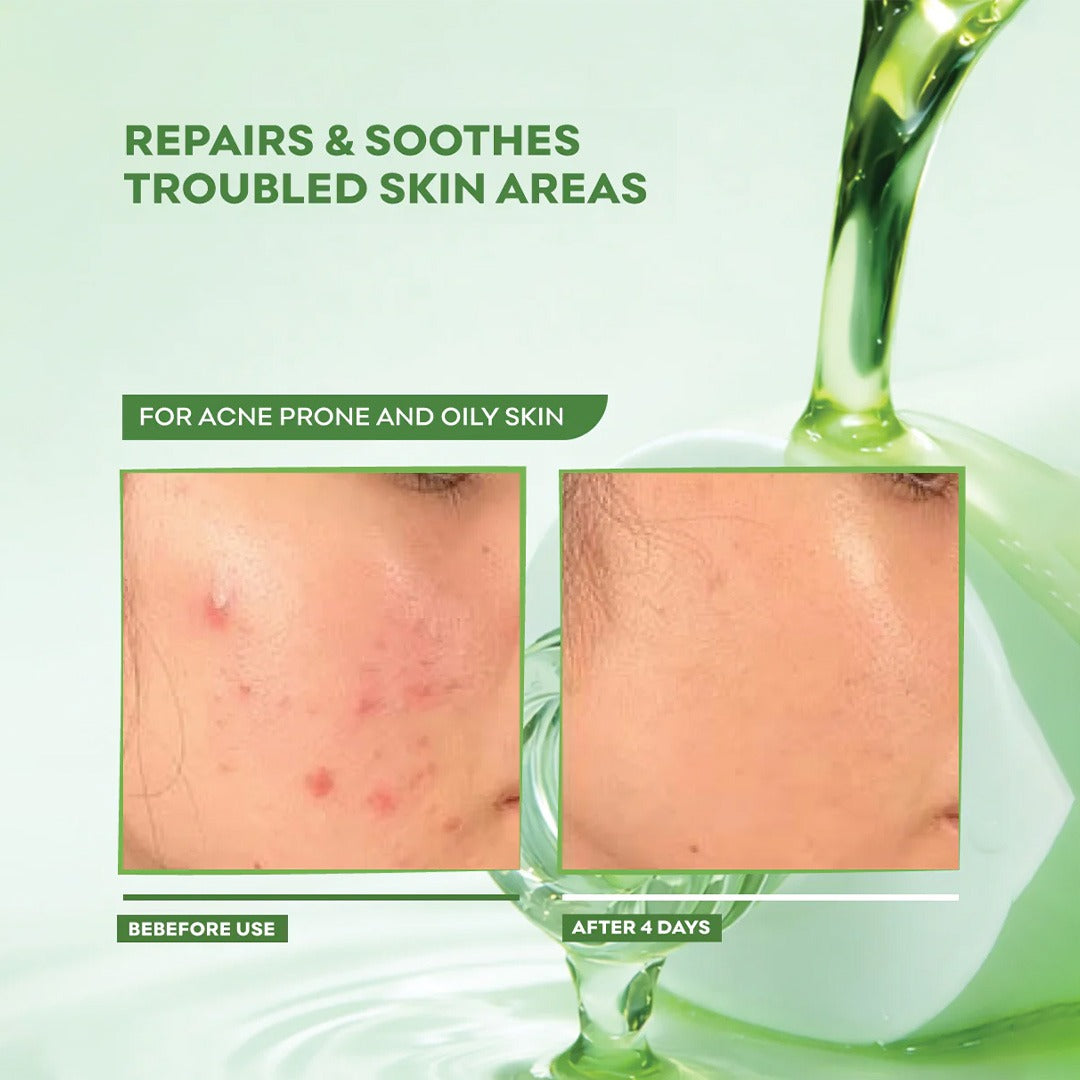 Acne Repair Serum