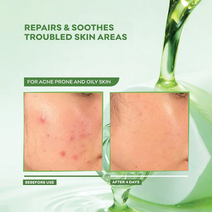 Acne Repair Serum