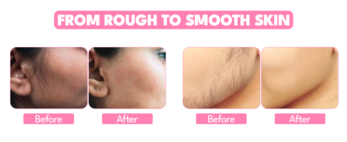 Painless Cream Wax + Strip Pack ( Free )