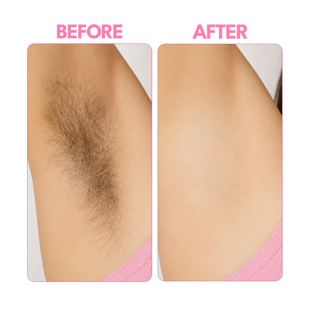 Before and After Results
